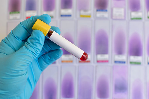 A importância do exame de sangue no diagnóstico de doenças graves (Foto: Pixabay)
