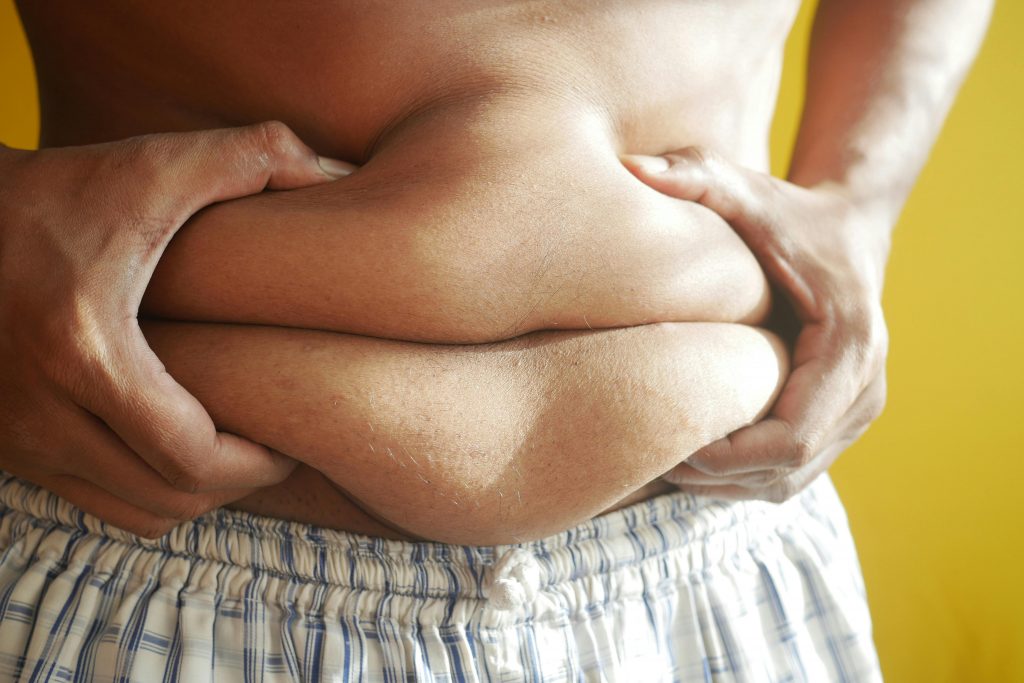 Em 20 anos, 48% dos adultos brasileiros (com mais de 18 anos) viverão com obesidade e outros 27% estarão com sobrepeso, totalizando 75%. (Foto: Pexels)