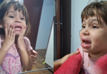 A pequena Anna Lívia, de 5 anos, passou por um sufoco ao se olhar no espelho e ver seus lábios totalmente inchados. (Foto: Instagram)