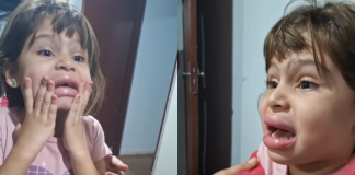 A pequena Anna Lívia, de 5 anos, passou por um sufoco ao se olhar no espelho e ver seus lábios totalmente inchados. (Foto: Instagram)