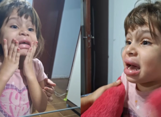 A pequena Anna Lívia, de 5 anos, passou por um sufoco ao se olhar no espelho e ver seus lábios totalmente inchados. (Foto: Instagram)