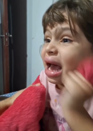 Com isso, em vídeo publicado no Instagram, a mãe, Tainara Davanzo, explicou que a filha usou a tampinha do desodorante para fazer pressão na boca. O resultado, porém, não agradou nem um pouco a menina. (Foto: Instagram)