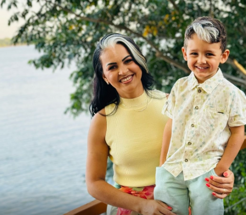 No caso, Fátima Gomes e seu filho, Théo, também possuem as mechas brancas típicas do piebaldismo. (Foto: Reprodução)