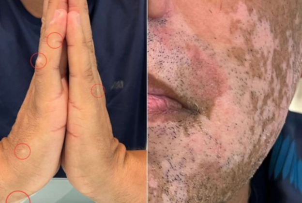 Durante anos, ele adiou a separação por causa dos filhos, mas, ao se divorciar em 2022, solicitou uma recuperação inesperada. (Foto: Divulgação)