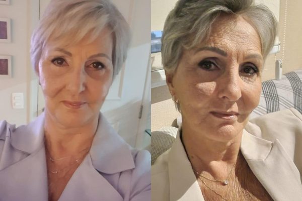 Tecnologia para arritmia ajuda Maria Aparecida a recuperar sua rotina após crises