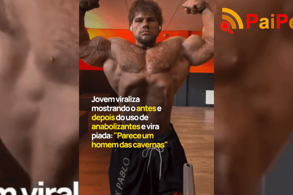 Jovem viraliza mostrando o antes e depois do uso de anabolizantes