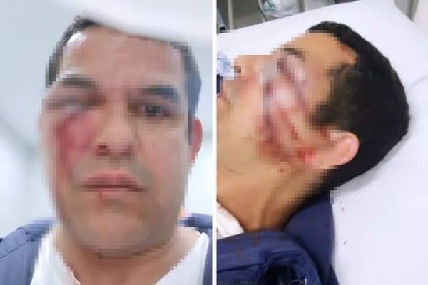 Vendedor é espancado por seis homens em Florianópolis em ataque homofóbico