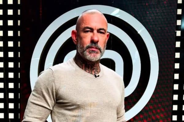 Henrique Fogaça revela lesões de acidente que o afastou do MasterChef