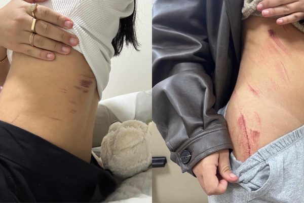 Casal lésbico relata momentos de horror durante estupro em Sobradinho