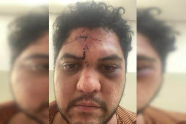 Advogado Alan Araújo Dias sofre agressão em Goiânia após emboscada