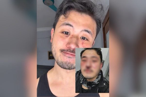 Professor Ricardo Akira Matsufuji relata agressão homofóbica no metrô de São Paulo