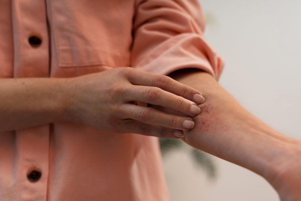 Infecções fúngicas raras podem afetar órgãos vitais e são perigosas