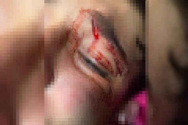 Mãe de adolescente agredido por PM em Catalão (GO) relata terror vivido pelo filho