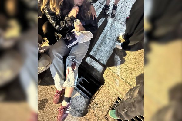 Jovem sofre acidente ao pisar em bueiro após show de Harry Styles em SP