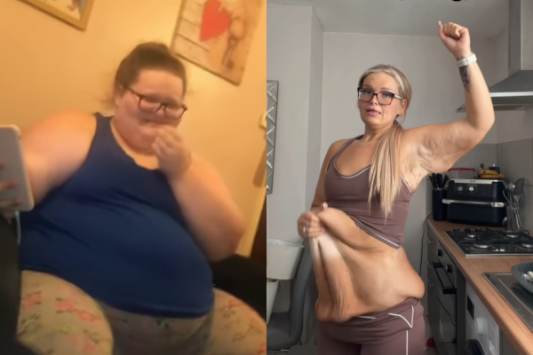 Britânica Laura Budreviciene compartilha transformação após perder 152 kg