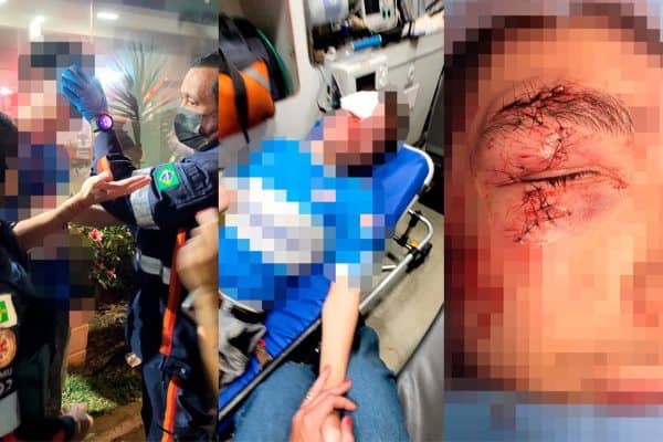 Jovem tem rosto desfigurado por morador de rua em Águas Claras e agressor é liberado