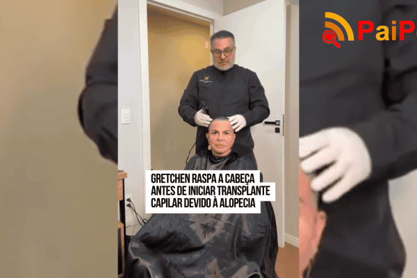 Gretchen raspa a cabeça antes de iniciar transplante capilar devido à alopecia
