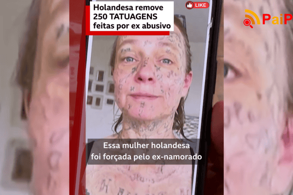 Holandesa remove 250 tatuagens feitas por ex abusivo