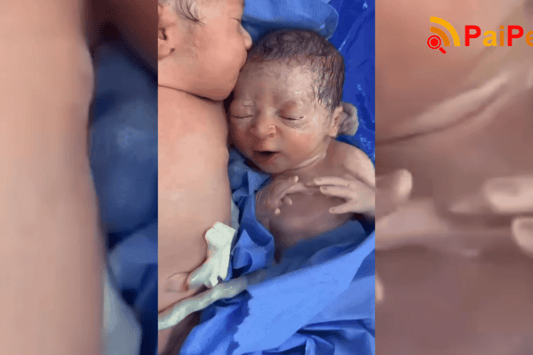 Gêmeos recém-nascidos se abraçam e se “beijam” após parto, como se ainda estivessem no ventre