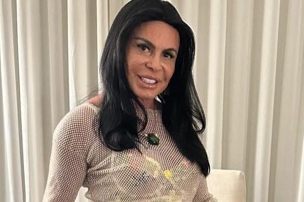 Gretchen faz transplante capilar por alopecia e especialistas discutem causas da queda de cabelo