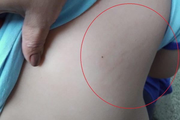 Monitor investigado por agressão a aluno autista em escola do DF
