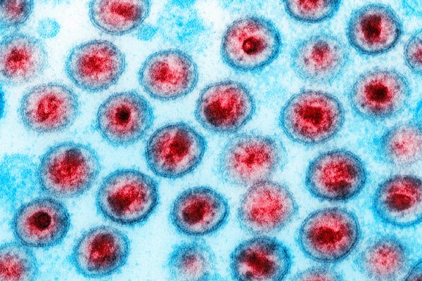 STM cassa posto de militar que transmitiu HIV intencionalmente a duas mulheres