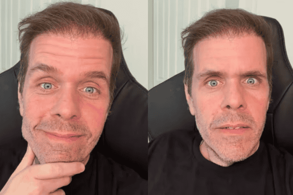 Após surto, família de Perez Hilton intervém e faz novas relações