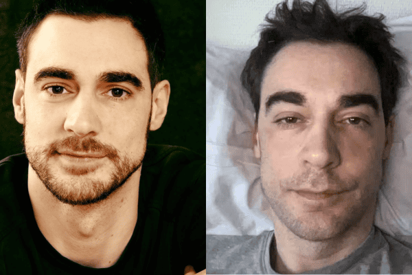 Famoso ator francês toma atitude dramática após sofrer com cirurgia que deu errado: “Não viver”