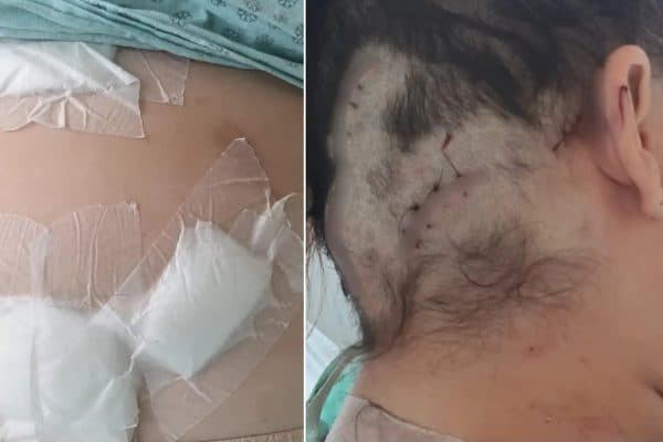 Homem de 27 anos é preso no Ceará após tentativa de feminicídio com 12 facadas