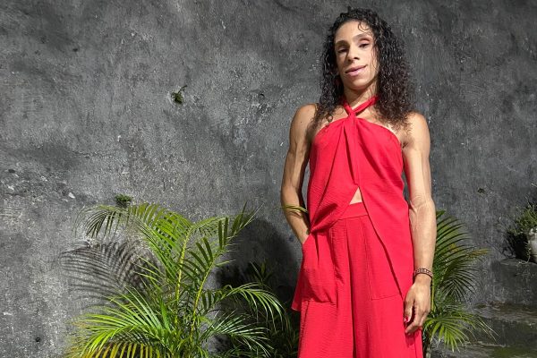 Doença rara faz Karyn Cerqueira, 29, ter quase nenhuma gordura aparente