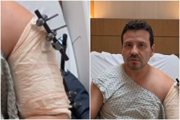 Médico é baleado em golpe do retrovisor no Rio de Janeiro pela segunda vez em quatro meses