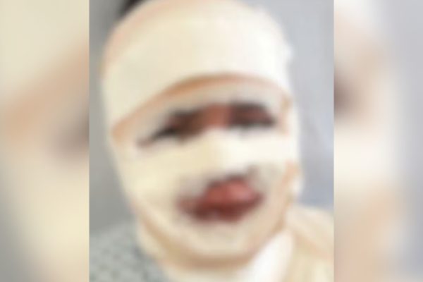 Fisioterapeuta é detida por jogar água quente em jovem em BH