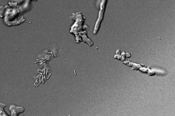 Cientistas descobrem ameba que sobrevive a 64 °C nos EUA