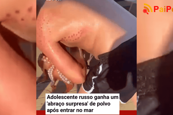 Adolescente russo ganha um ‘abraço surpresa’ de polvo após entrar no mar