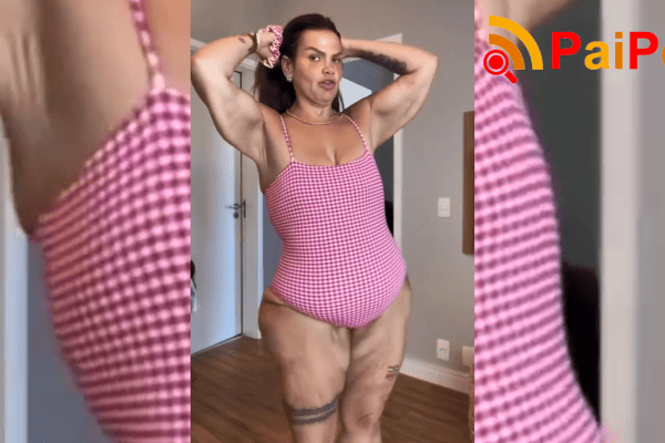 Thais Carla sobre excesso de pele após perder 120 kg: “Não deixo de viver”