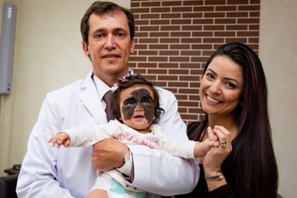 Criança tem a vida transformada após inúmeras cirurgias. Veja o resultado!