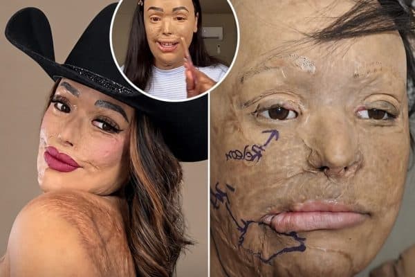 Mulher tenta salvar melhor amiga de acidente e vive tragédia inimaginável