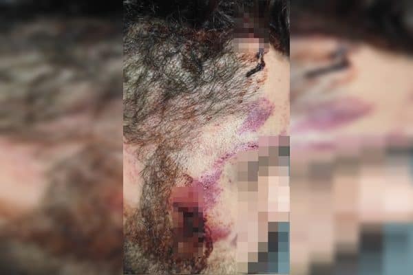 Motorista de aplicativo é agredido no DF após discussão de trânsito