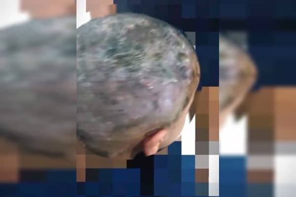 Pais presos em Cristalina por maus-tratos; criança tinha larvas na cabeça