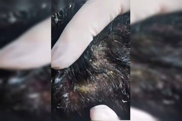 Pais presos por maus-tratos após criança ser encontrada com larvas na cabeça