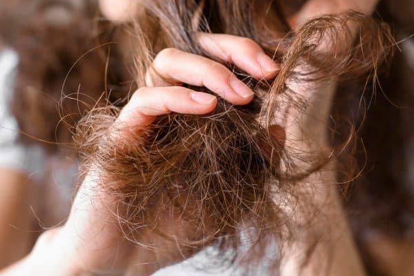 Médicas esclarecem o fenômeno scab hair e suas causas