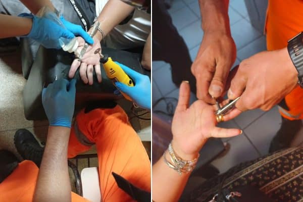 Bombeiros de MG atendem 163 casos de objetos presos ao corpo em 15 dias