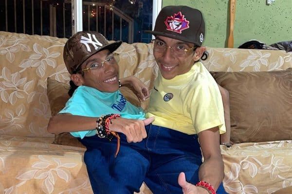 Gêmeos siameses do Equador falecem aos 27 anos na Colômbia
