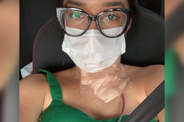 Jovem descobre câncer de tireoide aos 15 anos e médico comenta aumento de casos