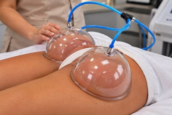 Médico explica técnica de ventosa nos glúteos que promete aumentar volume
