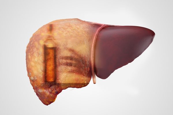 Hepatologista explica benefícios ao fígado de ficar 30 dias sem álcool