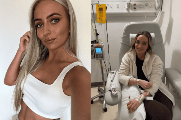 Veja o antes e depois da mulher viciada em bronzeamento artificial que morreu as 30 anos